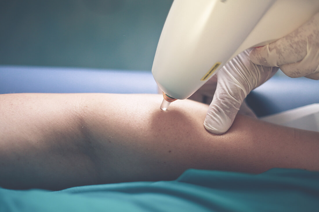 Hautarzt Lichtenberg Berlin - Praxis Dr. Hoppe - Leistungen - Ästhetische Medizin
