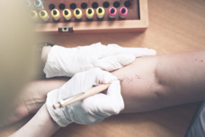 Hautarzt Lichtenberg Berlin - Dr. Hoppe - Leistungen - Allergologie